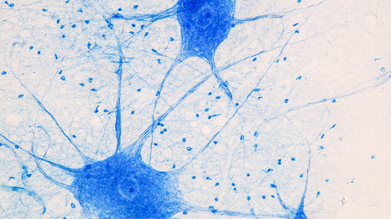 Photograph on motor neuron under a microscope