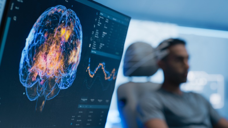 Image of brain scan showing neural pathways