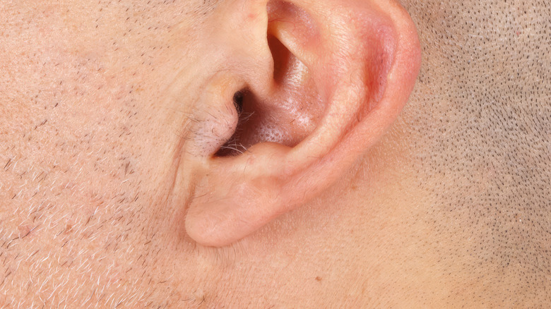 close up of man's ear with small Darwin's point