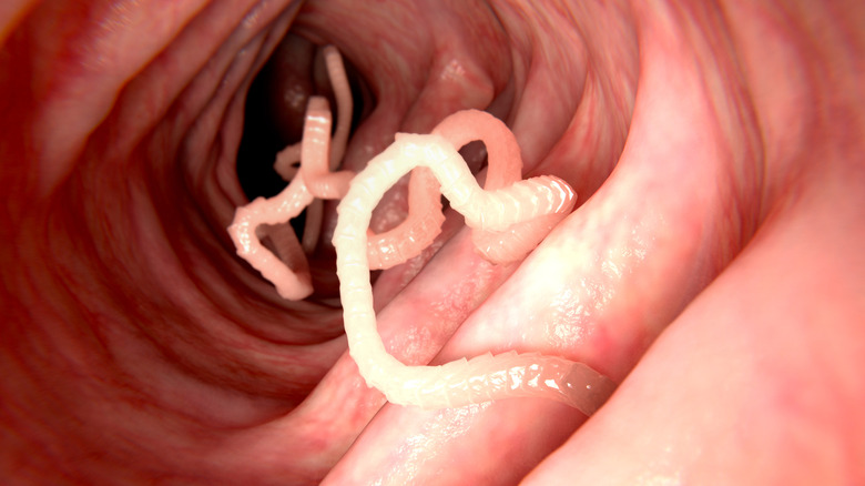 Tapeworm in the intestines