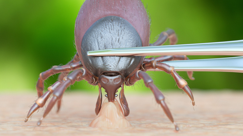 illustration of removing tick with tweezers