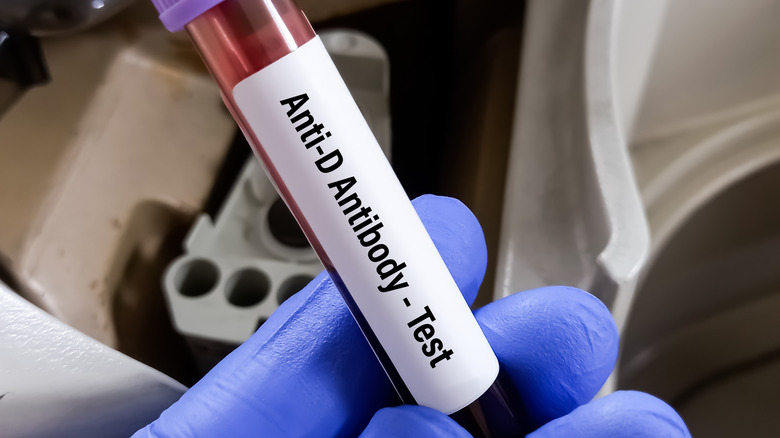 Hand holding blood vial for RhD testing