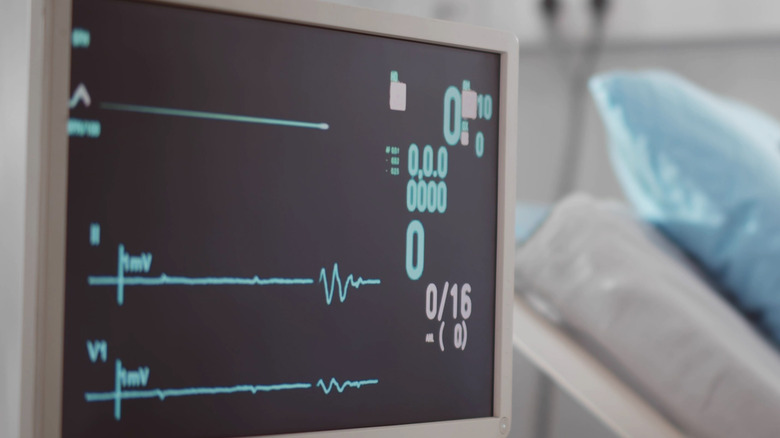 A monitor displaying no vital readings next to a hospital bed