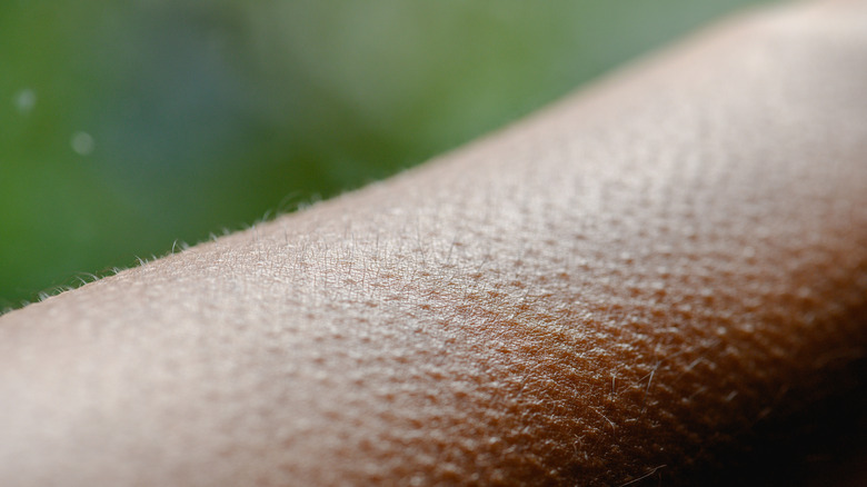Close up of arm with hair standing on end and goosebumps