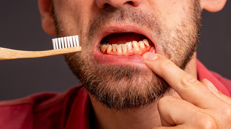 Man examining his teeth and inflamed gums