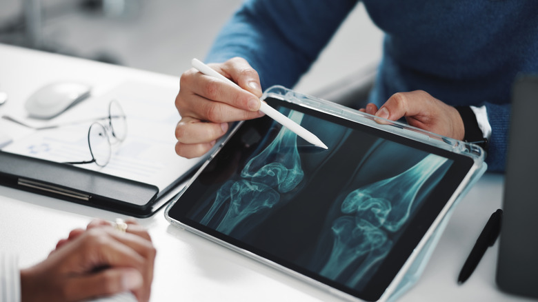 Doctor showing patient images of bones on tablet