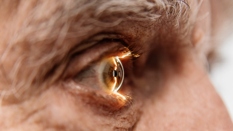 A man's eye is shown in closeup with a light shining into it