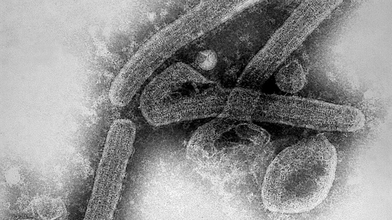 Transmission electron micrograph of a Marburg virus.