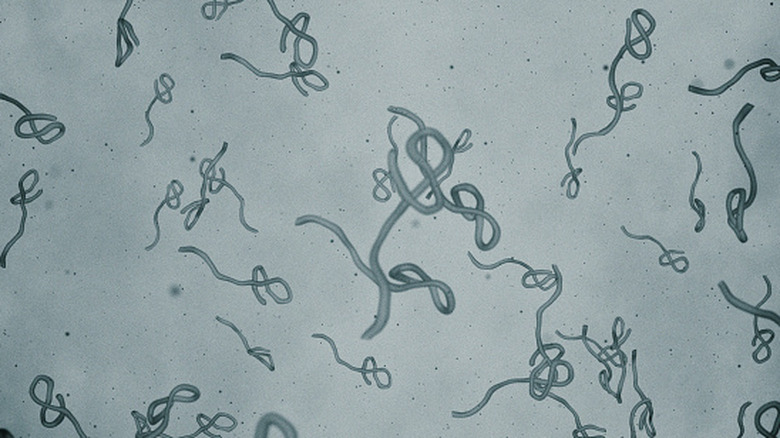 Ebola virus under the microscope.