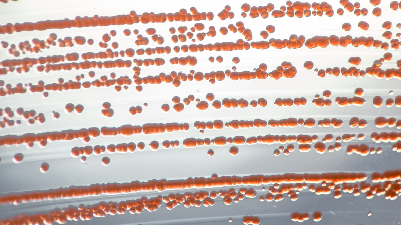 Close-up of Serratia marcescens in a Petri dish