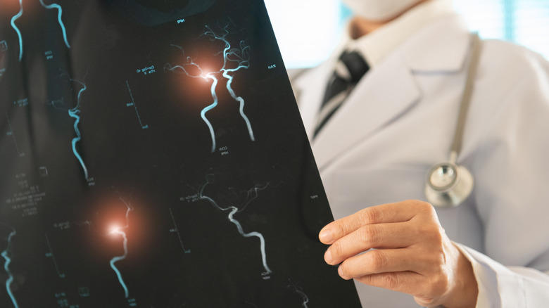 A doctor's hand holding a brain scan with glowing sections of neural networks