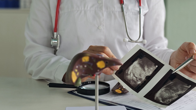 Doctor examining liver ultrasound images next to a model of a liver