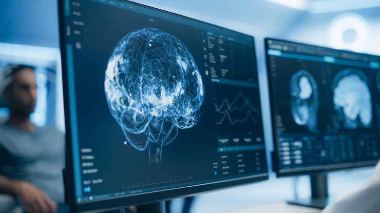 Medical brain scans showing up on screens