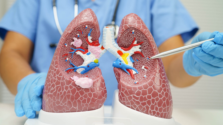Doctor pointing to a diagram of the lungs