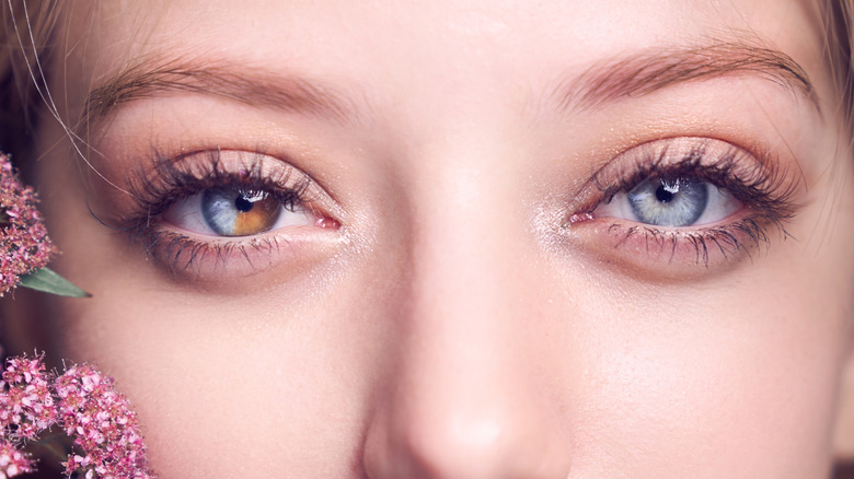 A girl with heterochromia in her eyes looking at the camera