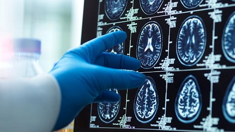 A collection of brain scans examined by gloved hand