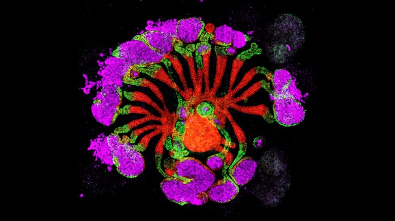 Lab grown human synthetic kidney organoids (hSKOs), also known as human kidney progenitor assembloids (hKPAs), showing the formation of radial nephrons connected to a central collecting system