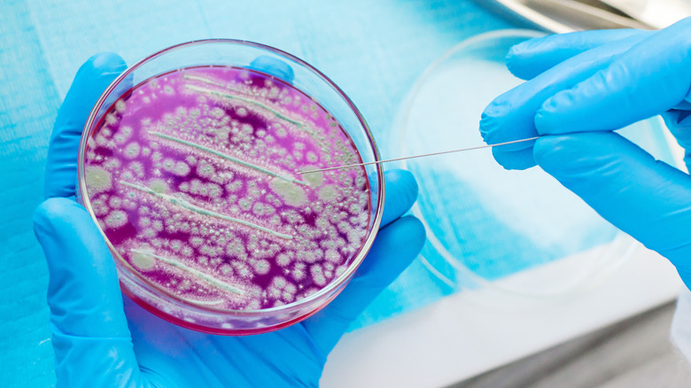 Scientist studying bacteria in a Petri dish