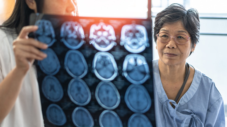 A doctor holding up a brain scan in front of an older patient