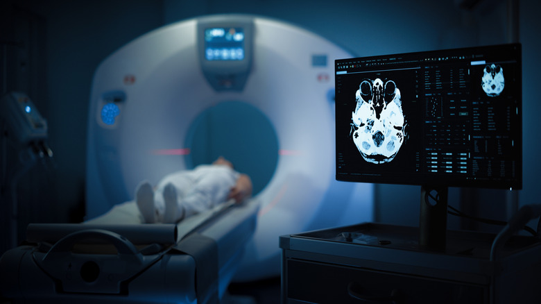 A person undergoing an MRI brain scan, with an image of their brain appearing on a computer monitor