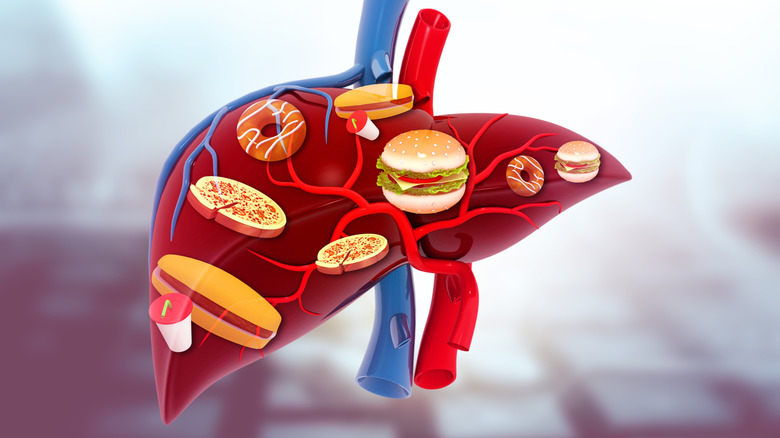 Cartoon liver with junk food images superimposed, hamburgers, pizza, donuts, hot dogs