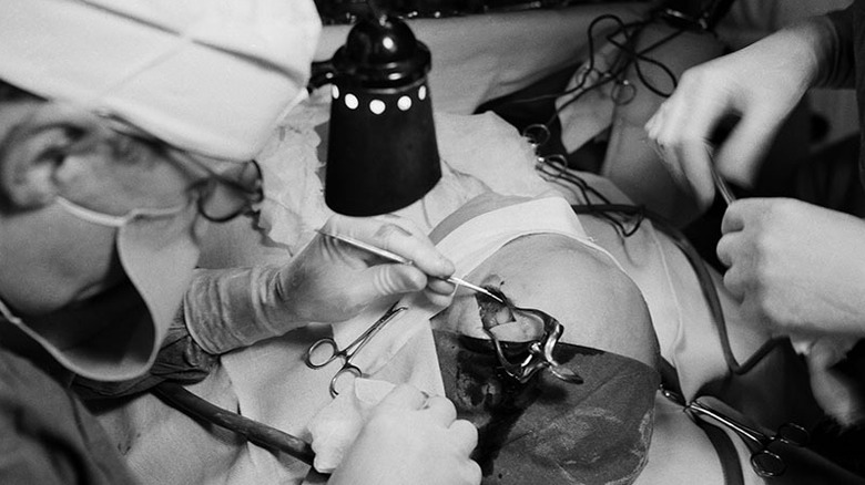 Doctors performing a lobotomy in the 1940s