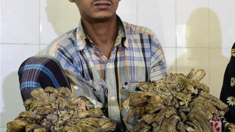 An example of a epidermodysplasia verruciformis on the hands