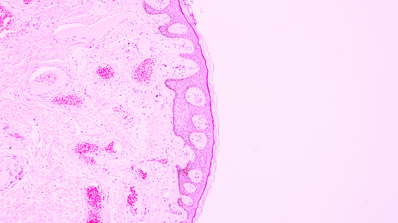 Cancer cells under a microscope