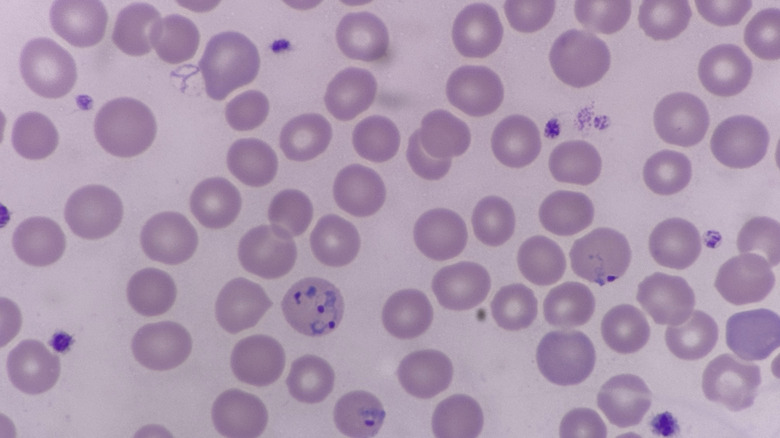 Plasmodium vivax under a microscope.