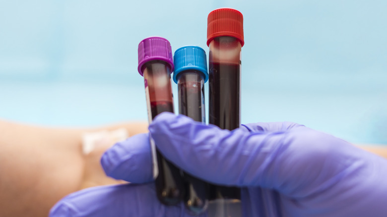 A gloved hand holds up three vials of blood against a blue background