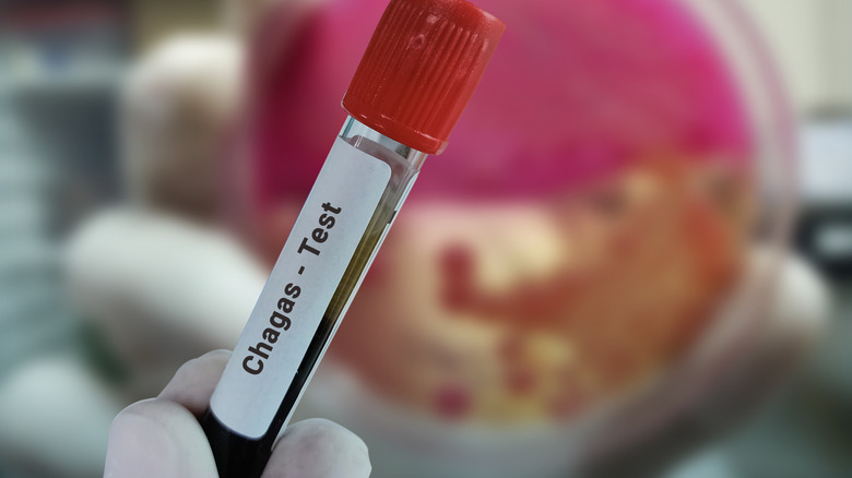 A blood sample in a clear sealed vial in gloved hand with words "Chagas - Test"