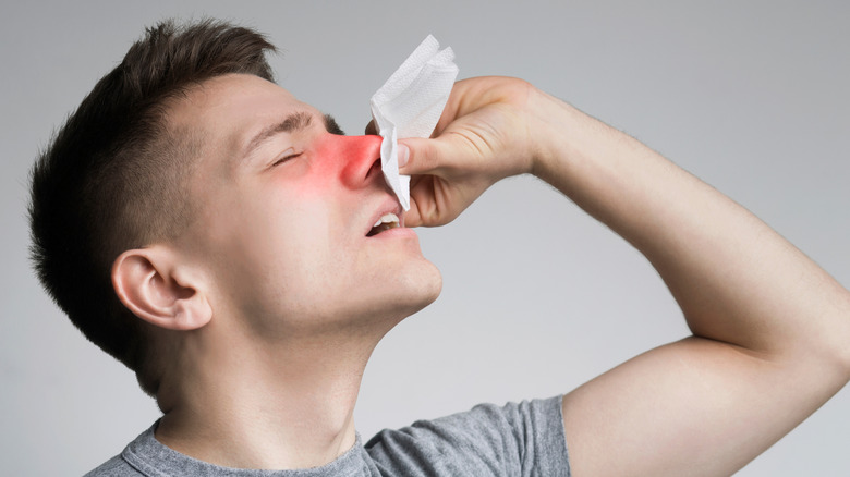 Man with nosebleed tipping head backward and holding nose