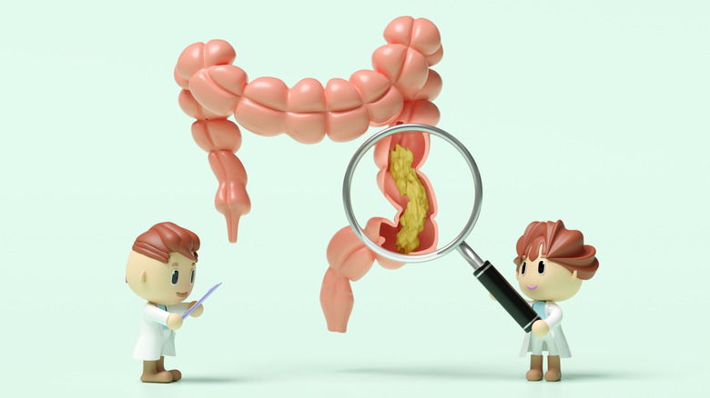 Concept of mini doctors looking at a giant intestines model under a giant magnifying glass