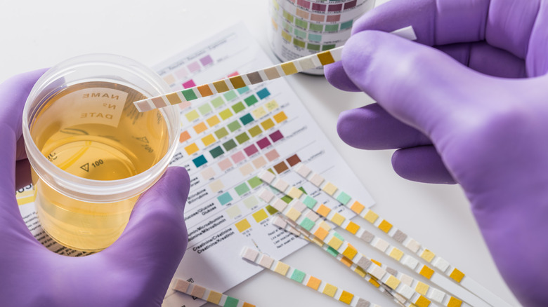 lab technician testing urine sample