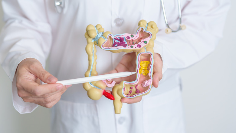 Doctor holding an intestinal model and pointing to the colon