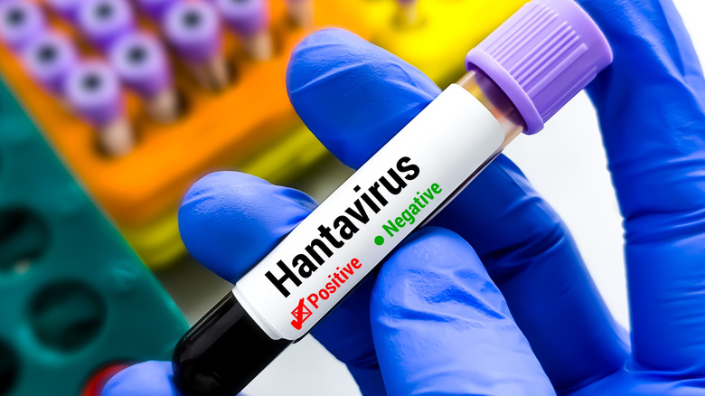 Gloved hand holding a blood vial labeled for hantavirus testing