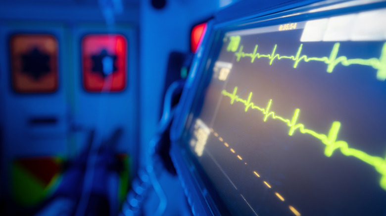 A close-up of a screen that is monitoring vital signs including heart rhythm.