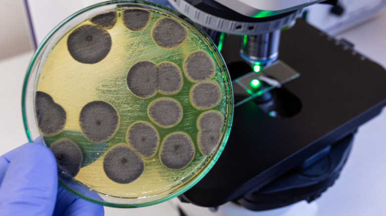 A petri dish of mold growths in lab