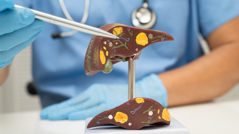 Medical professional pointing to a liver model