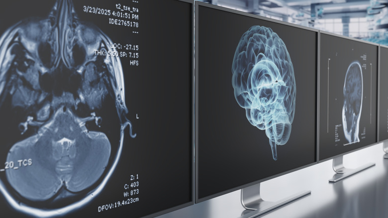 High-resolution brain scans showing detailed anatomy of the brain