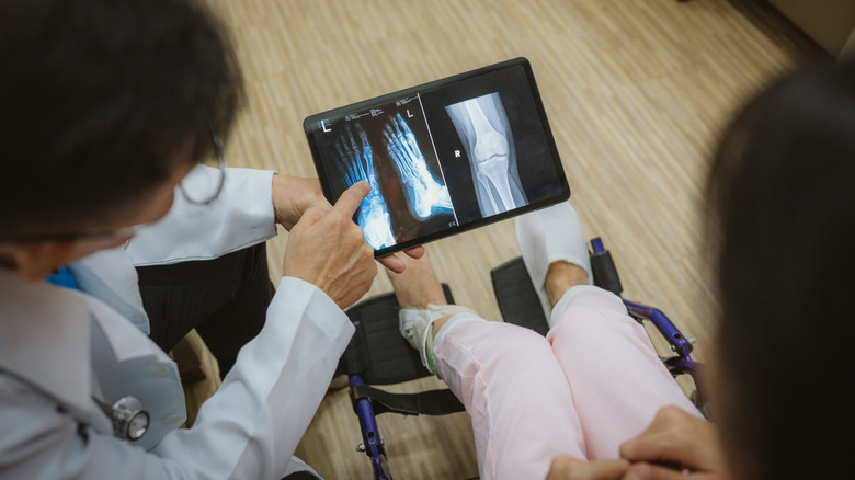 Doctor going over x-rays of lower leg and foot with patient