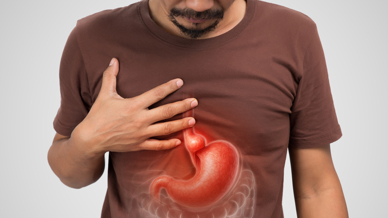 A stomach illustration over a man's abdomen