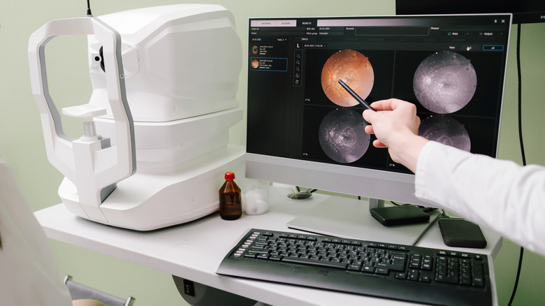 Doctor pointing to the images from retinal analysis