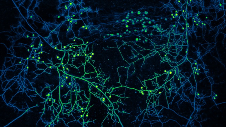 Mycelium of arbuscular mycorrhizal fungi with false color