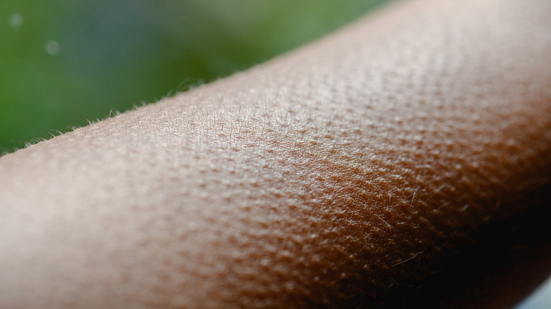 A closeup shot of a persons arms against a green background with goosebumps visible on their skin
