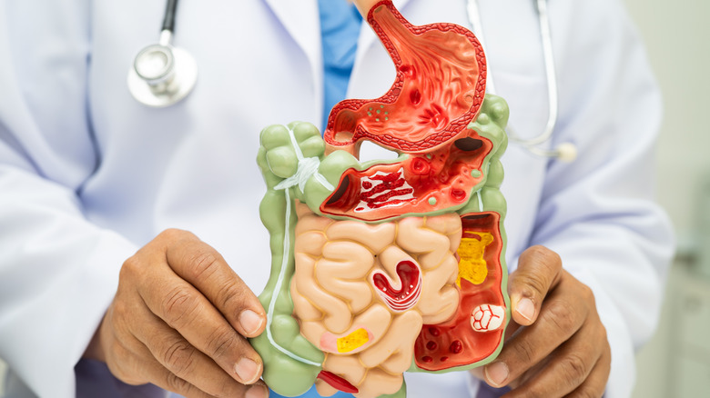 A doctor holding a model of internal organs