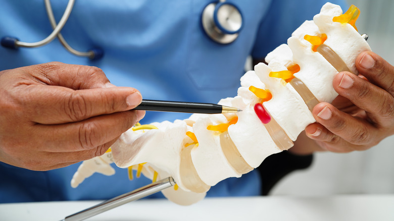 A doctor holds a model of the lower spine including the coccyx
