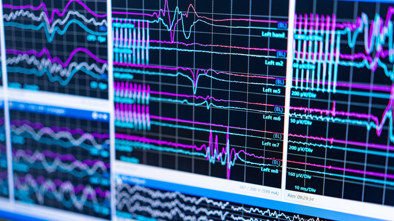 Brainwave patterns from an EEG on a computer screen