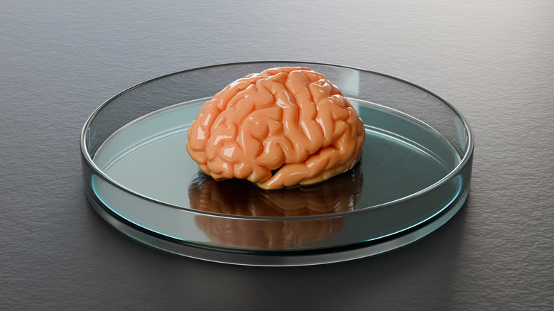 Model of a brain in a petri dish