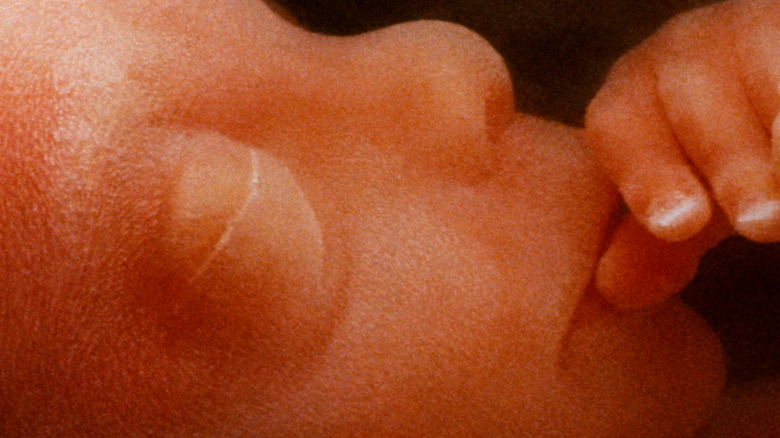 Close up of face of human fetus in utero